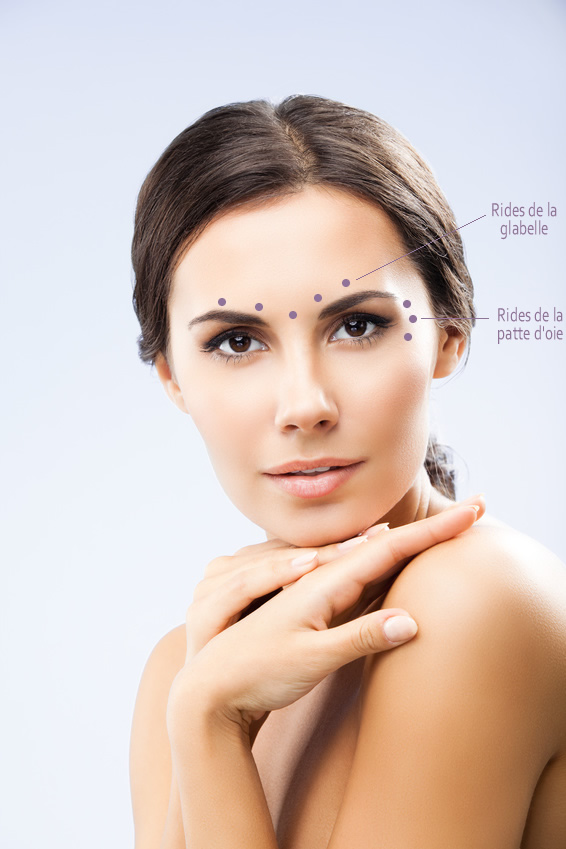 Lieux d'injection et rides corrigées par injection de botox